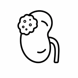 Kidney-(Renal)-Cancer