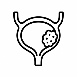 Bladder-Cancer