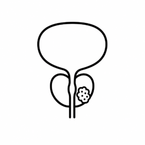 Prostate Cancer
