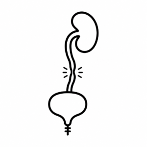 Stricture Ureter