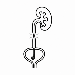 Stricture Ureter — Re-implantation-&-Dilatation-Treatment
